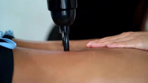 Close Up Of Physiotherapist Treating Lower Back Pain With Electronic Massage Dev Stock Footage 332666029