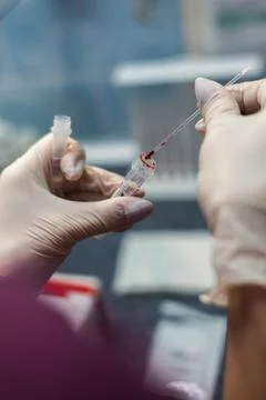 The close plan of the laboratory assistant in gloves performing a blood test Stock Photos