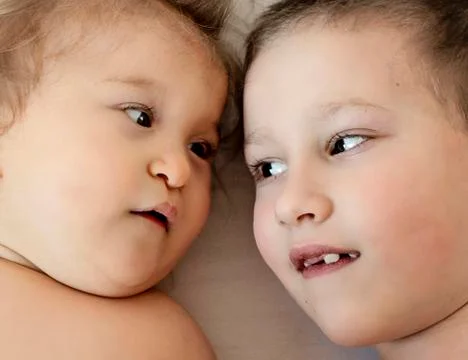 Close-up portrait of siblings lying on bed. Boy loves his disabled brother Foto stock