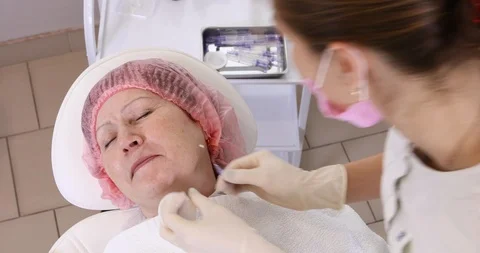 Close-up of procedure for face lifting PDO Suture operation,  Stock Footage 102028059