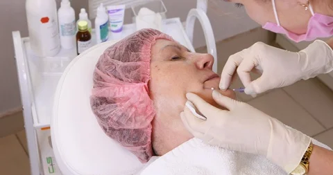 Close-up of procedure for face lifting PDO Suture operation, Stock Footage 102028181