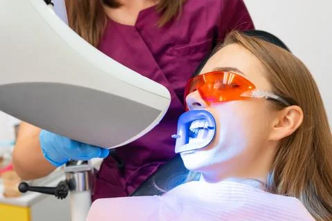 Close up procedure of whitening of teeth using UV lamp for blond woman at Stock Photos