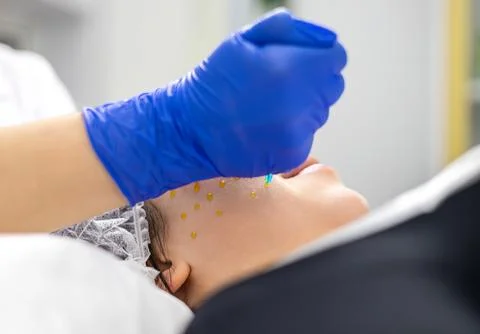 Close-up of the process of applying a yellow solution to the client's face Foto stock