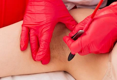Close-up of the process of hair removal using an electric epilator with beaut Stock Photos