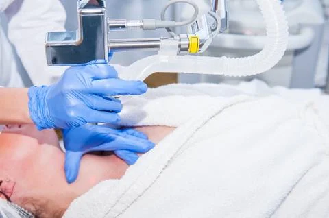 Close up process of laser peeling. Laser rejuvenation and skin treatment of p Stock Photos