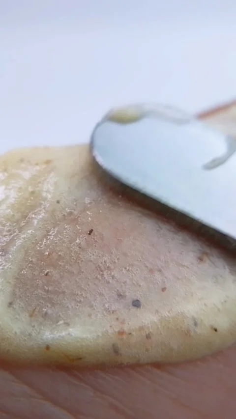 Close up process of spreading natural moisturizing cream on skin using metal Vídeo Stock 334874540
