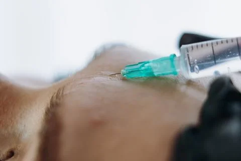 Close up of professional hands making a rejuvenation injection into woman frown Stock Photos