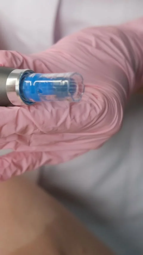 Close-up of a professional microneedling device held in pink medical gloves Видео 325123511