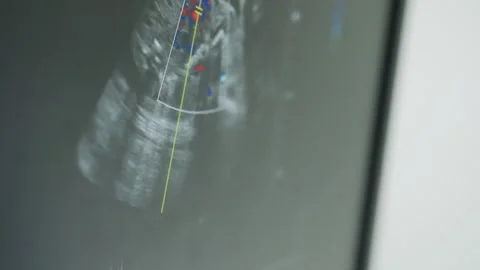 Close Up of Radiography Machine Showing Angular Wave Movement Stock Footage 306034305