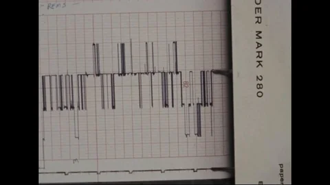 Close-up of readout chart on ECG machine - 1969 Stock Footage 104331881