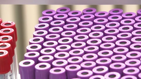 A close-up of red and purple test tubes. Motion camera. Stock Footage 147597891