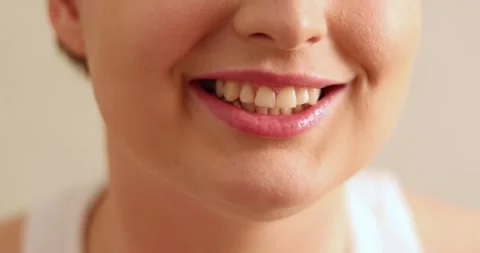 Close up satisfied smiling client of bleaching whitening dental treatment pro Stock Footage 300364748