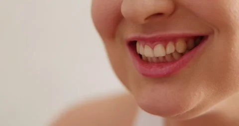 Close up satisfied smiling client of bleaching whitening dental treatment pro Stock Footage 300365318