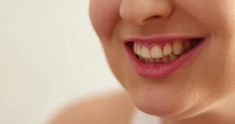 Close up satisfied smiling client of bleaching whitening dental treatment pro Stock Footage 303351751