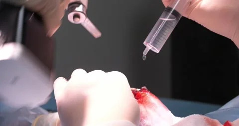 Close-up of sawing off the sharp edge of a broken bone on a pet's broken paw. A Stock Footage 238780208