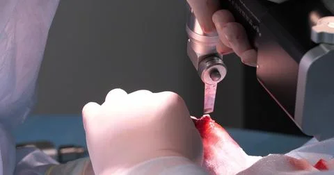 Close-up of sawing off the sharp edge of a broken bone on a pet's broken paw. A Stock Photos