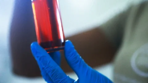 Close up of a scientist inspecting a bottle of purified macauba palm oil. Stock Footage 101691043