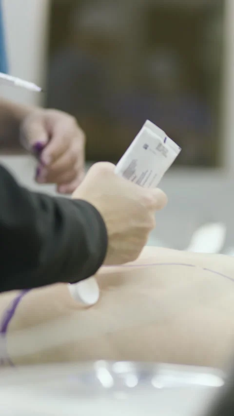 Close-up, sequence applying gel to skin marked with guide lines Stock Footage 345686506