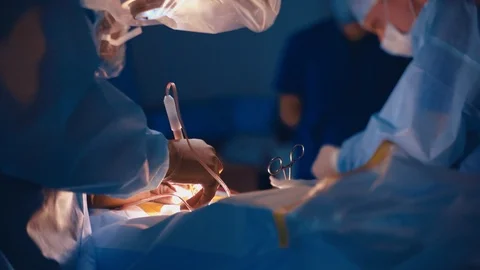 Close-up shoot of operating process in clinic. Stock-Footage 120567097