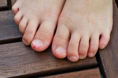 Close up shot of bad behavior or habit of biting toes. Refer as stress, anxie Stock Photos