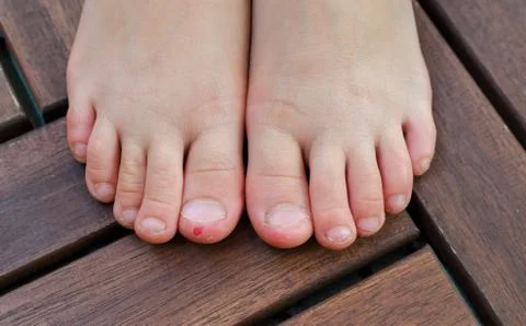 Close up shot of bad behavior or habit of biting toes. Refer as stress, anxie 库存照片