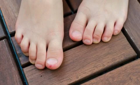 Close up shot of bad behavior or habit of biting toes. Refer as stress, anxie Stock Photos