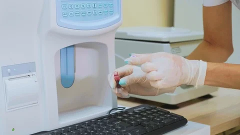 Close-up shot of blood testing machine in veterinary laboratory Stock Footage 93780915