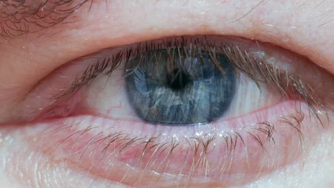 Close up shot of blue human eye opening in bright sunlight. Male caucasian. Video stock 105166740