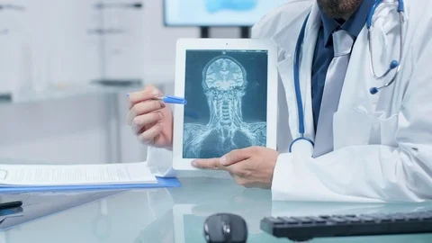 Close up shot of doctor hands explaining something about a X Ray scan on a Stock Footage 108580477