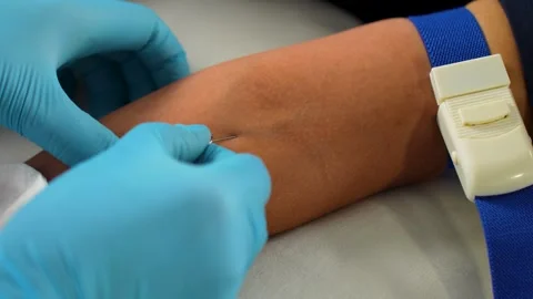 Close-up shot of a doctor hands inserting a needle into a patient arm for b.. Stock Footage 314765947