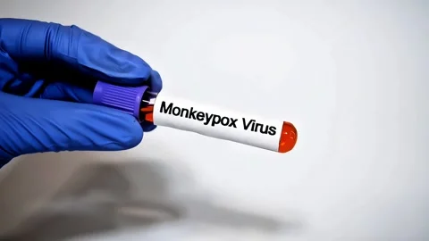 Close up shot of doctor holding Monkeypox positive test of laboratory Stock Footage 307330787