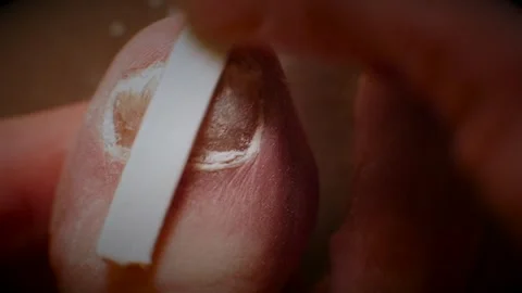 Close up shot. Filing down a big toe nail infected with fungus. Video stock 268929648