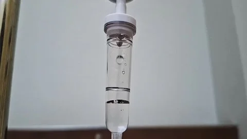 Close-up shot of liquid dripping slowly inside a medical IV drip chamber in.. Video stock 346232485