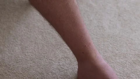 Close-up shot of a man removing multiple ticks from a mans shin after being Stock Footage 310768350