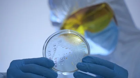 Close-up shot of microbiologist looking at a Petri dish with bacteria through Stock Footage 106264134