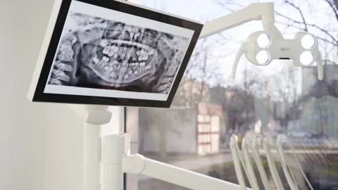 Close-up shot of panoramic x-ray of milk teeth on the screen in modern dental Stock Footage 269994342