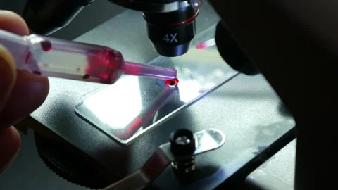 Close-up shot scientific laboratory microscope examining a drop of blood virus Stock Footage 241444106