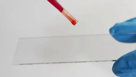A close-up shot - a scientist in the laboratory examines blood diseases Video stock 119144604