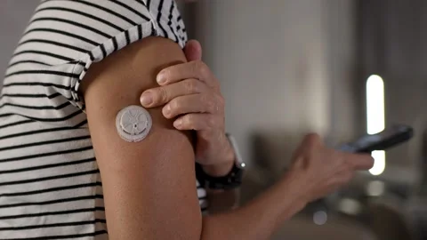 Close-up shot of a woman using a smartphone diabetes app to scan a continuo.. Stock-Footage 344584098