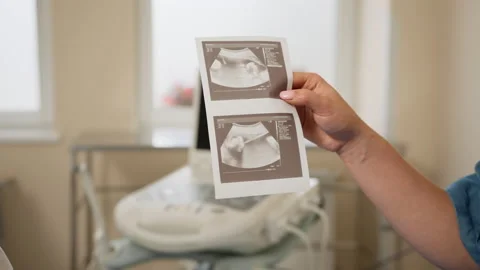 Close-up shot woman's hands holding sonogram image of healthy unborn baby. Close Stock Footage 162813075