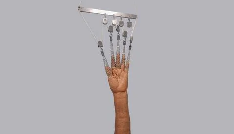 Close-up of skeleton traction with frame in a patient with fracture of the wr Stock Photos