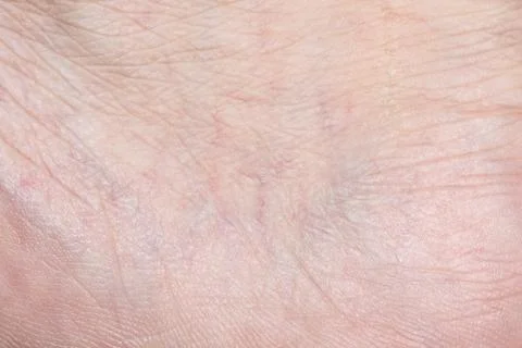 Close-up skin Stock Photos