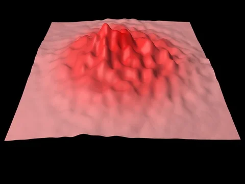 Close up of skin in process of becomming infected, irritated Stock Footage 70685531