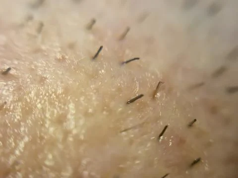 Close-up of skin texture revealing tiny hair follicles and fine details, Stock Photos