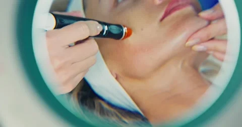 Close-Up Skincare Procedure with Handheld Device at Clinic Video stock 323610142