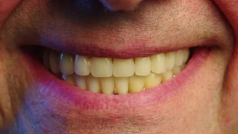 Close-up smile of an elderly man with artificial teeth. Periodontal disease and Stock Footage 236024025