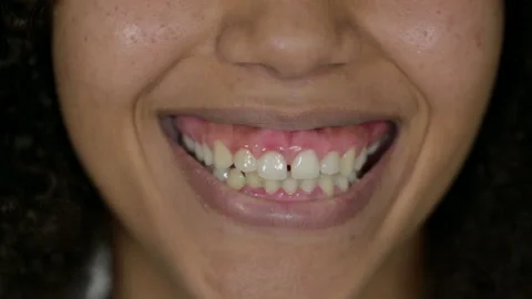 Close up of Smiling Lips of Young African Woman 스톡 동영상 141683771