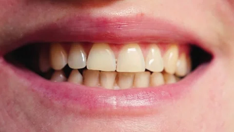 Close-up of a smiling womans, teeth, healthy natural smile. Concept of dental Stock Footage 323383446