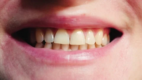 Close-up of a smiling womans, teeth, healthy natural smile. Concept of dental Stock Footage 330287800