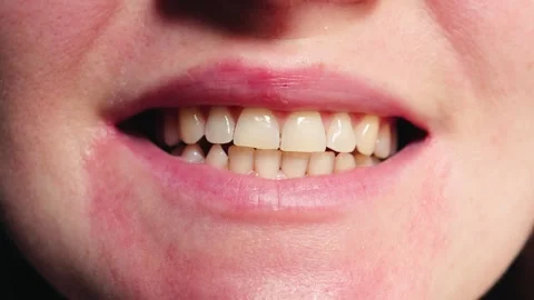Close-up of a smiling womans, teeth, healthy natural smile. Concept of dental Stock Footage 334836404